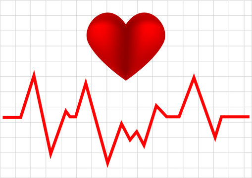 heart monitor graph