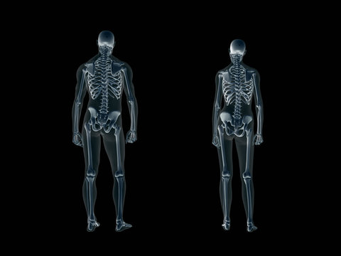xray, x-ray of the human body, man and woman.