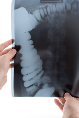doctor examining an abdominal x-ray