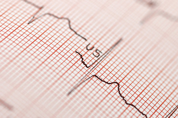 electrocardiogram in close up