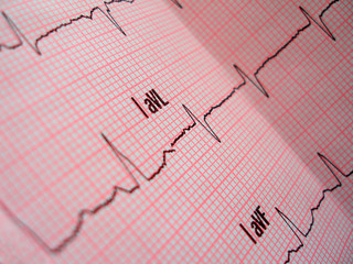 heart analysis scheme