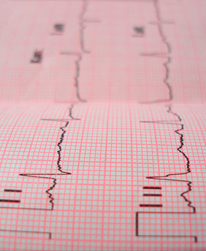 Heart Analysis Scheme