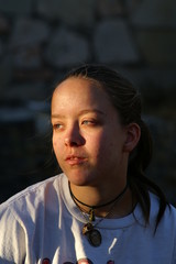 teenage girl with acne 3