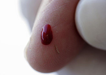 blood test