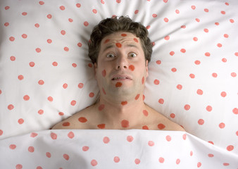 man with red spots on face and body