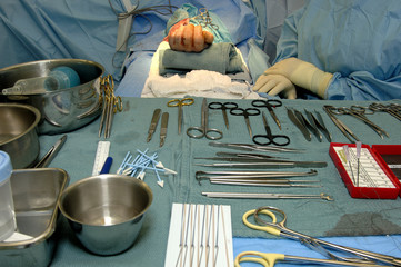 surgery-hand operation