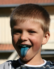 boy with blue tongue