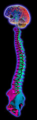 brain and spine on black