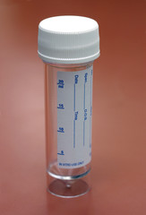 specimen bottle