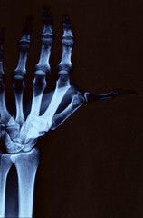 hand radiography