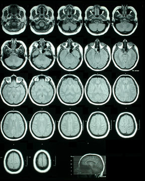a sheet of mri (magnetic resonance images) of the