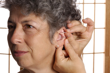 acupuncture in ear zone