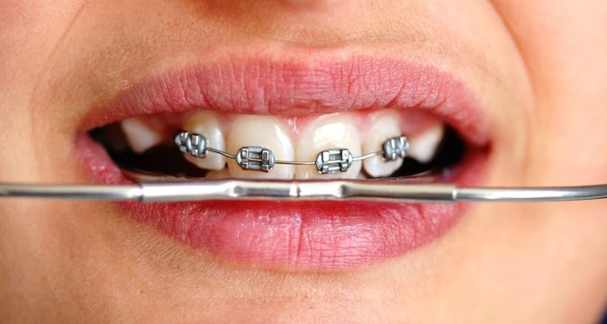 orthodontie