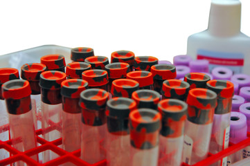 blood tests