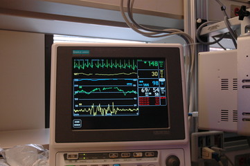 vital signs monitor