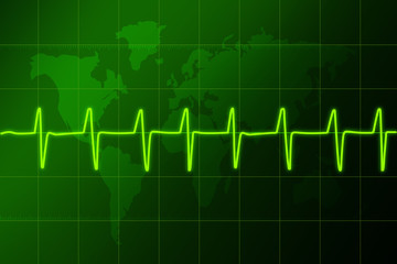 cardiogram heart rhythm3