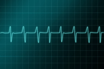 cardiogram ritm