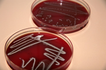 bakterienanzucht