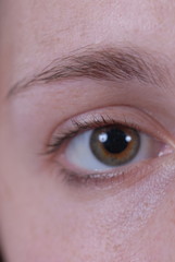 right eye 3