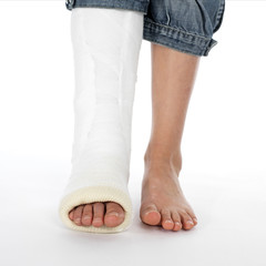 girl with a broken leg