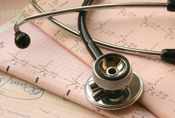 cardiological test analysis
