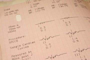 cardiological test results