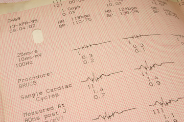 Fototapeta premium cardiological test results