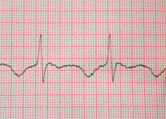Naklejka premium ecg graph