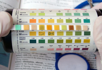 urine ph test