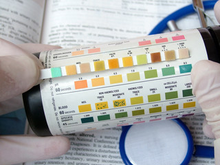 urine test diagnosis