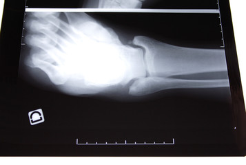 img_2811radiographie