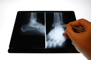 img_2815radiographie