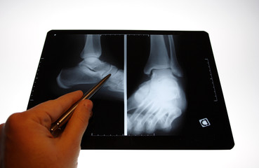 img_2817radiographie