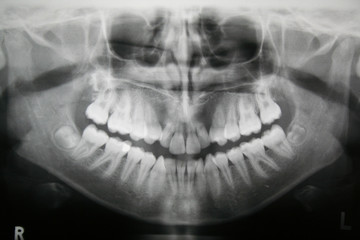 dental x-ray