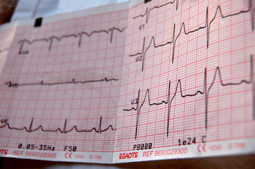 heart rate