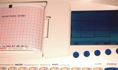 ecg