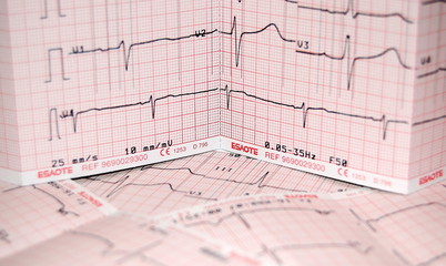 ecg