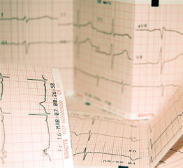 heart rate