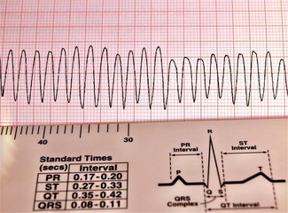 cardiac