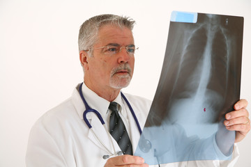 doctor examining an x-ray - obrazy, fototapety, plakaty