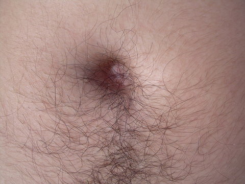nombril