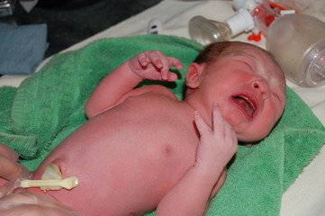 Le cordon ombilical du nouveau-né : couleur blanc/ jaunâtre et aspect gélatineux à la naissance 