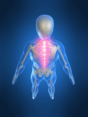 schmerzende wirbels&auml;ule