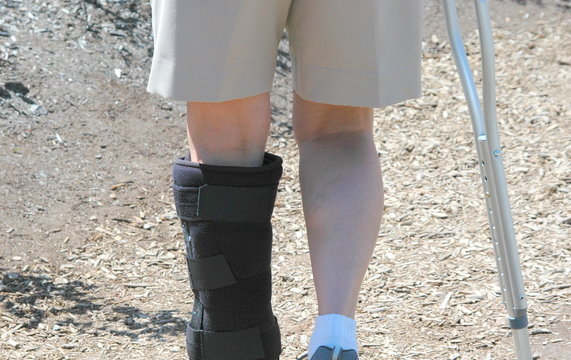 Female with a broken leg.