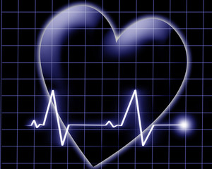 Heart beat on a monitor
