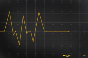ekg