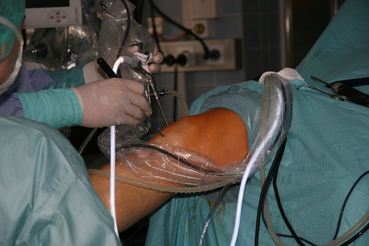 Knie-OP
