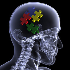 Skeleton X-Ray - Puzzling 2