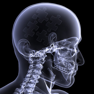 Skeleton X-Ray - Puzzling