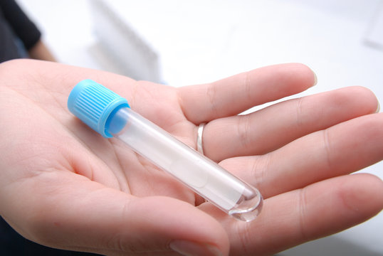 test-tube in woman hand